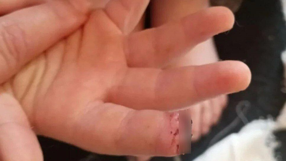 Заведующая детсада в Тверской области получила штраф за травму воспитанника